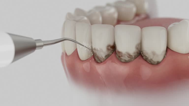 Trusted Dental Implants service in Kingsley, MI - Dentist Open Now